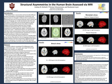 Structural Asymmetries of the Human Brain Assessed via MRI